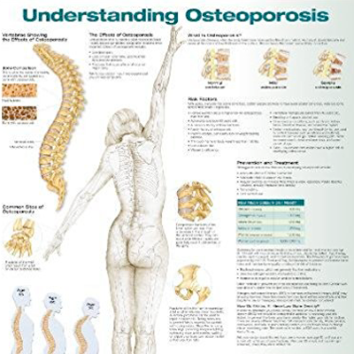 Poster laminado  medidas 66 cm x 51 cm entendiendo osteoporo